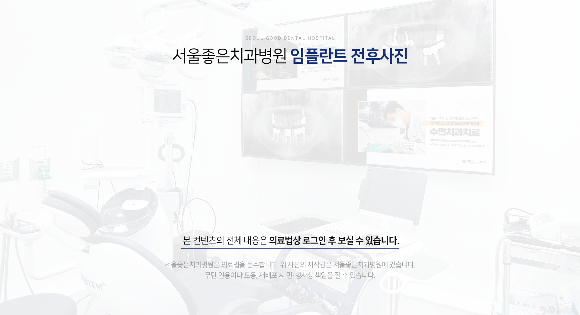 서울좋은치과병원-임플란트-전후사진