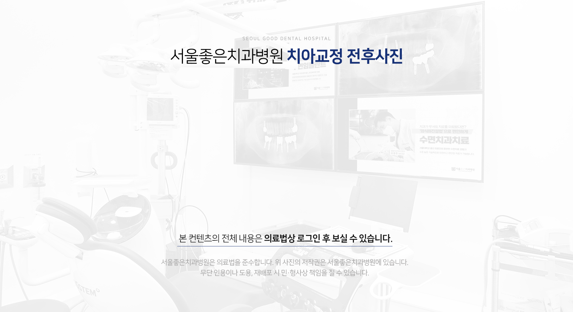 서울좋은치과병원-치아교정-전후사진