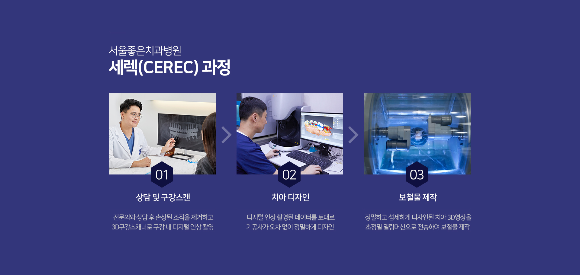 세렉-과정-1단계-상담-및-구강-스캔-전문의와-상담-후-손상된-조직을-제거하고-3D-구강-스캐너로-구강-내-디지털-인상-촬영-2단계-치아-디자인-디지털-인상-촬영된-데이터를-토대로-기공사가-오차-없이-정밀하게-디자인-3단계-보철물-제작-정밀하고-섬세하게-디자인된-치아-3D-영상을-초정밀-밀링머신으로-전송하여-보철물-제작