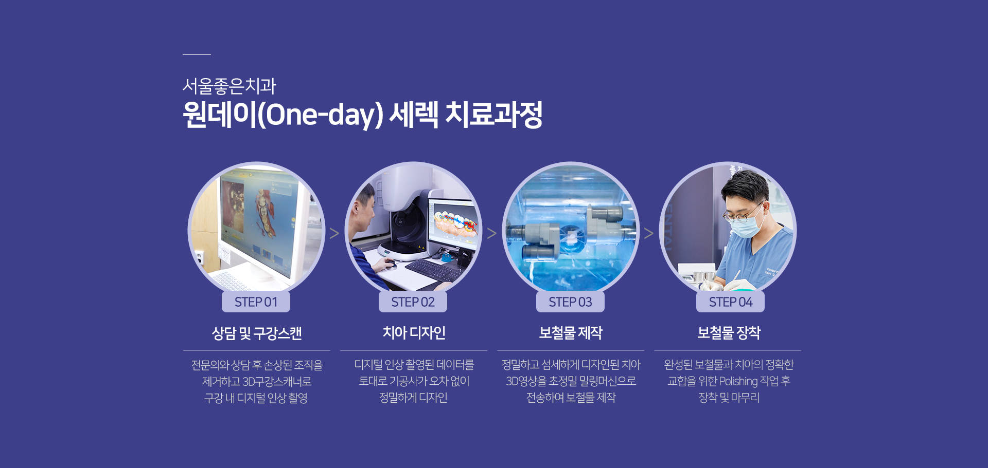 원데이-세렉-치료-과정-1단계-상담-및-구강-스캔-전문의와-상담-후-손상된-조직을-제거하고-3D-구강-스캐너로-구강-내-디지털-인상-촬영-2단계-치아-디자인-디지털-인상-촬영된-데이터를-토대로-기공사가-오차-없이-정밀하게-디자인-3단계-보철물-제작-정밀하고-섬세하게-디자인된-치아-3D-영상을-초정밀-밀링머신으로-전송하여-보철물-제작-4단계-보철물-장착-완성된-보철물과-치아의-정확한-교합을-위한-Polishing-작업-후-장착-및-마무리