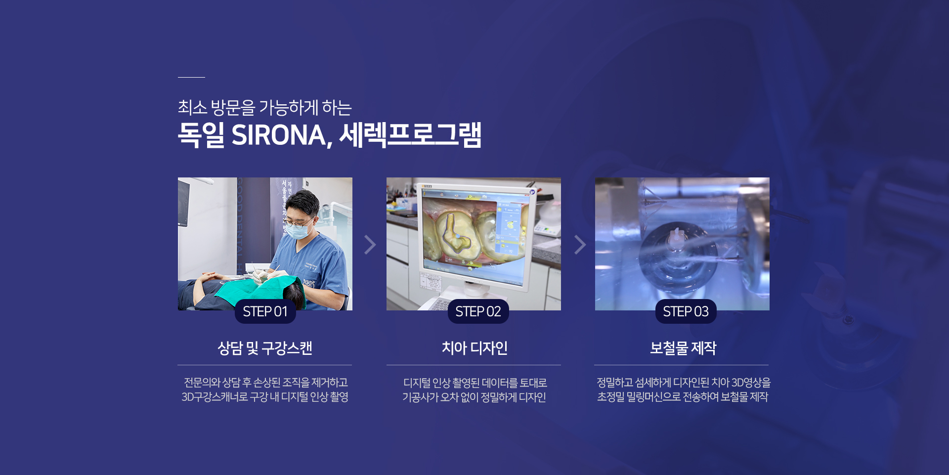 최소-방문을-가능하게-하는-독일-SIRONA-세렉-프로그램-1단계-상담-및-구강-스캔-전문의와-상담-후-손상된-조직을-제거하고-3D-구강-스캐너로-구강-내-디지털-인상-촬영-2단계-치아-디자인-디지털-인상-촬영된-데이터를-토대로-기공사가-오차-없이-정밀하게-디자인-3단계-보철물-제작-정밀하고-섬세하게-디자인된-치아-3D-영상을-초정밀-밀링머신으로-전송하여-보철물-제작