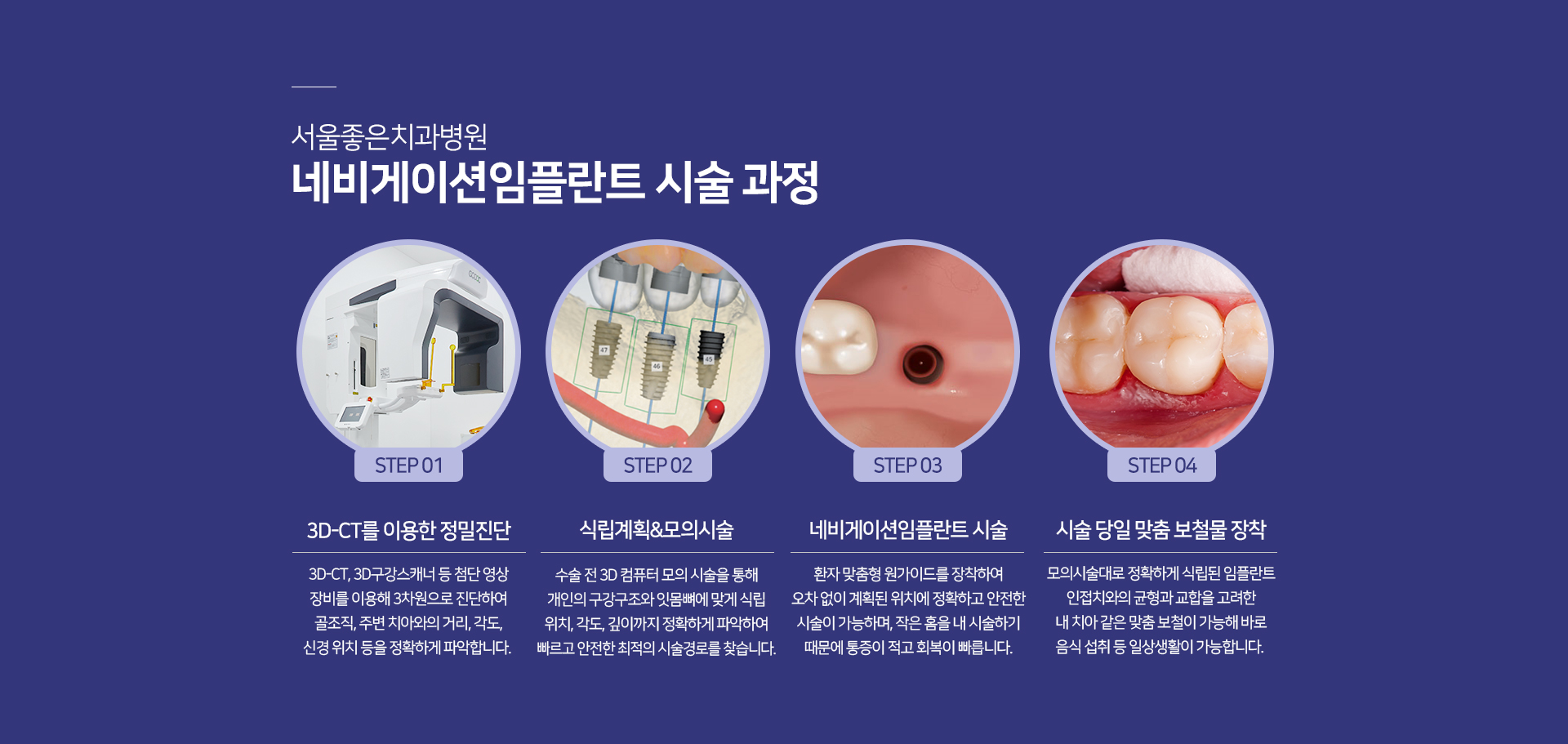 네비게이션-임플란트-시술-과정-1단계-3D_CT를-이용한-정밀진단-3D_CT-3D-구강-스캐너-등-첨단-영상-장비를-이용해-3차원으로-진단하여-골조직-주변-치아와의-거리-각도-신경-위치-등을-정확하게-파악합니다-2단계-식립-계획-및-모의-시술-수술-전-3D-컴퓨터-모의-시술을-통해-개인의-구강구조와-잇몸뼈에-맞게-식립-위치-각도-깊이까지-정확하게-파악하여-빠르고-안전한-최적의-시술-경로를-찾습니다-3단계-네비게이션-임플란트-시술-환자-맞춤형-원가이드를-장착하여-오차-없이-계획된-위치에-정확하고-안전한-시술이-가능하며-작은-홈을-내-시술하기-때문에-통증이-적고-회복이-빠릅니다-4단계-시술-당일-맞춤-보철물-장착-모의-시술대로-정확하게-식립된-임플란트-인접치와의-균형과-교합을-고려한-내-치아-같은-맞춤-보철이-가능해-바로-음식-섭취-등-일상생활이-가능합니다