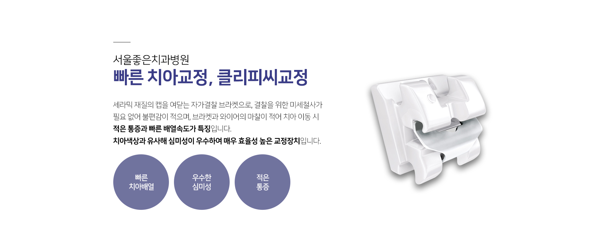 빠른-치아교정-클리피씨-교정-세라믹-재질의-캡을-여닫는-자가결찰-브라켓으로-결찰을-위한-미세-철사가-필요-없어-불편감이-적으며-브라켓과-와이어의-마찰이-적어-치아-이동-시-적은-통증과-빠른-배열-속도가-특징입니다-치아-색상과-유사해-심미성이-우수하여-매우-효율성-높은-교정장치입니다-빠른-치아배열-우수한-심미성-적은-통증