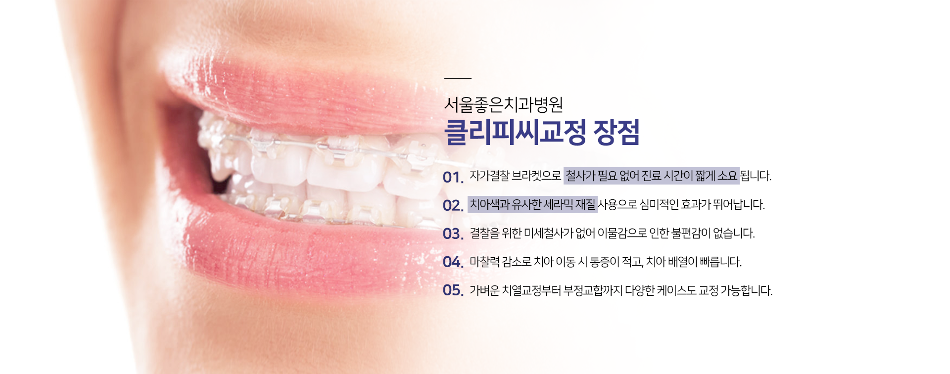 클리피씨-교정-장점-자가결찰-브라켓으로-철사가-필요-없어-진료-시간이-짧게-소요됩니다-치아색과-유사한-세라믹-재질-사용으로-심미적인-효과가-뛰어납니다-결찰을-위한-미세-철사가-없어-이물감으로-인한-불편감이-없습니다-마찰력-감소로-치아-이동-시-통증이-적고-치아-배열이-빠릅니다-가벼운-치열교정부터-부정교합까지-다양한-케이스도-교정-가능합니다