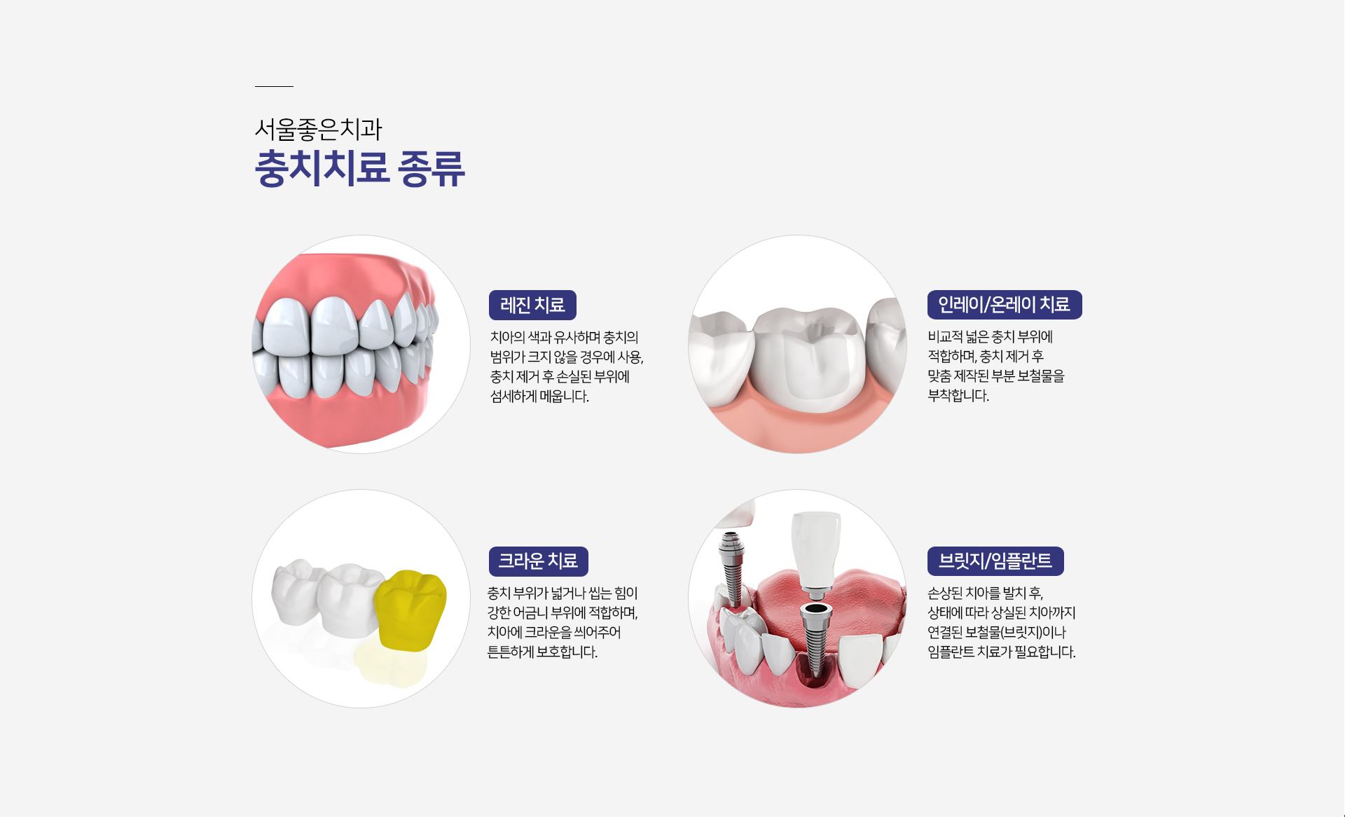 충치치료-종류1-레진-치료-치아의-색과-유사하며-충치의-범위가-크지-않을-경우에-사용-충치-제거-후-손실된-부위에-섬세하게-메웁니다-종류2-인레이/온레이-치료-비교적-넓은-충치-부위에-적합하며-충치-제거-후-맞춤-제작됨-부분-보철물을-부착합니다-종류3-크라운-치료-충치-부위가-넓거나-씹는-힘이-강한-어금니-부위에-적합하며-치아에-크라운을-씌워주어-튼튼하게-보호합니다-종류4-브릿지/임플란트-손상된-치아를-발치-후-상태에-따라-상실된-치아까지-연결된-보철물인-브릿지나-임플란트-치료가-필요합니다