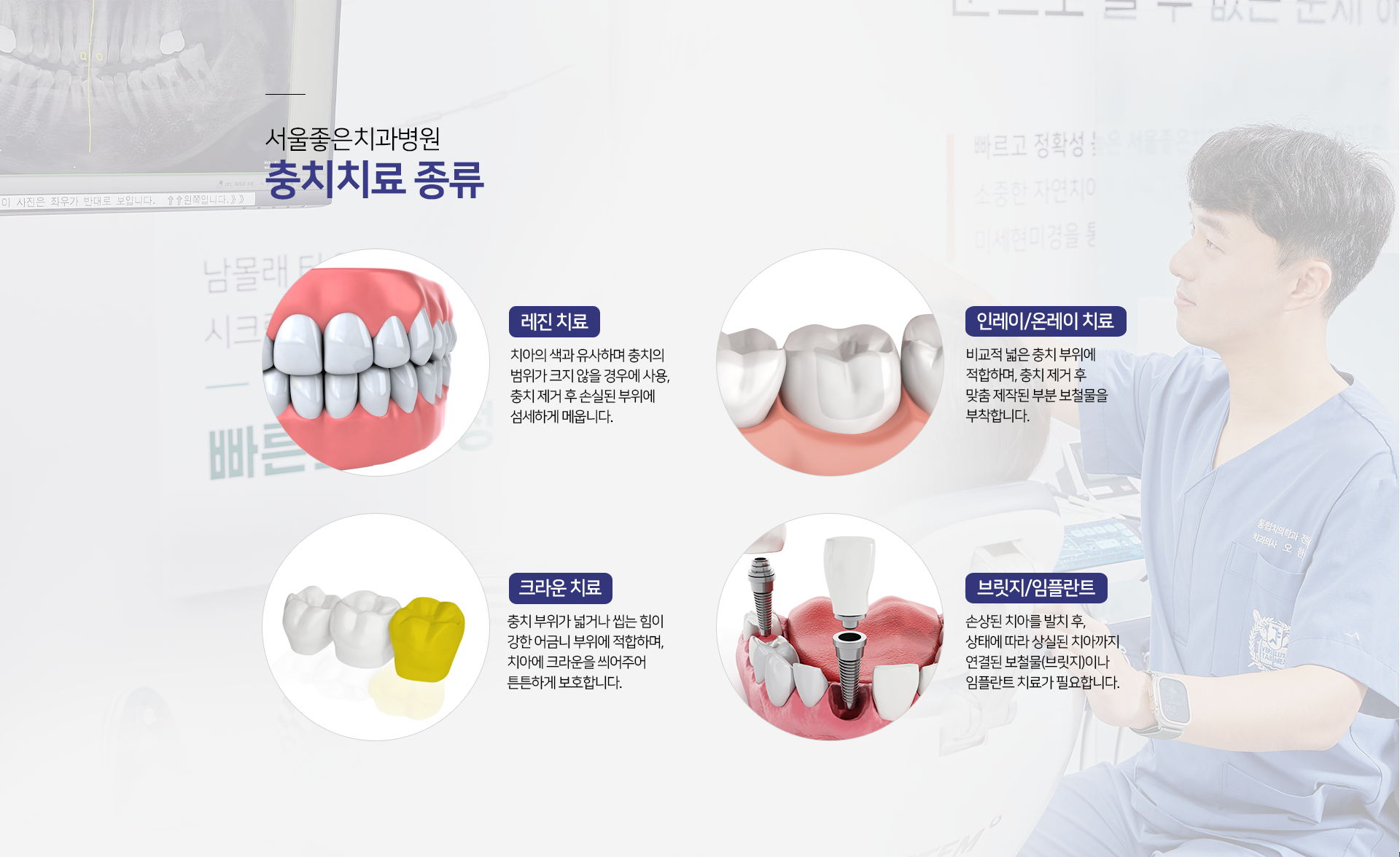 충치치료-종류1-레진-치료-치아의-색과-유사하며-충치의-범위가-크지-않을-경우에-사용-충치-제거-후-손실된-부위에-섬세하게-메웁니다-종류2-인레이/온레이-치료-비교적-넓은-충치-부위에-적합하며-충치-제거-후-맞춤-제작됨-부분-보철물을-부착합니다-종류3-크라운-치료-충치-부위가-넓거나-씹는-힘이-강한-어금니-부위에-적합하며-치아에-크라운을-씌워주어-튼튼하게-보호합니다-종류4-브릿지/임플란트-손상된-치아를-발치-후-상태에-따라-상실된-치아까지-연결된-보철물인-브릿지나-임플란트-치료가-필요합니다