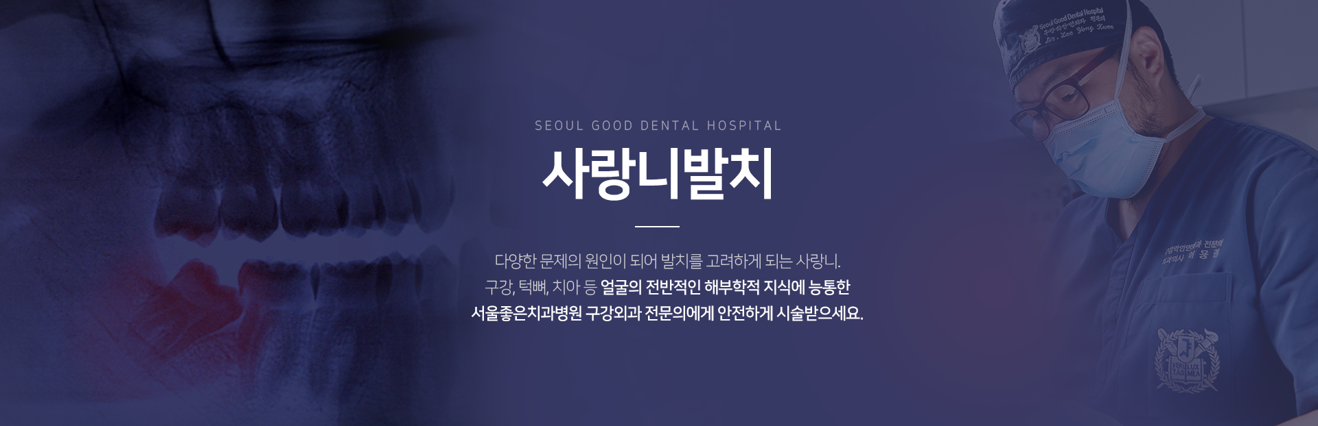 사랑니-발치-다양한-문제의-원인이-되어-발치를-고려하게-되는-사랑니-구강-턱뼈-치아-등-얼굴의-전반적인-해부학적-지식에-능통한-서울좋은치과병원-구강외과-전문의에게-안전하게-시술받으세요