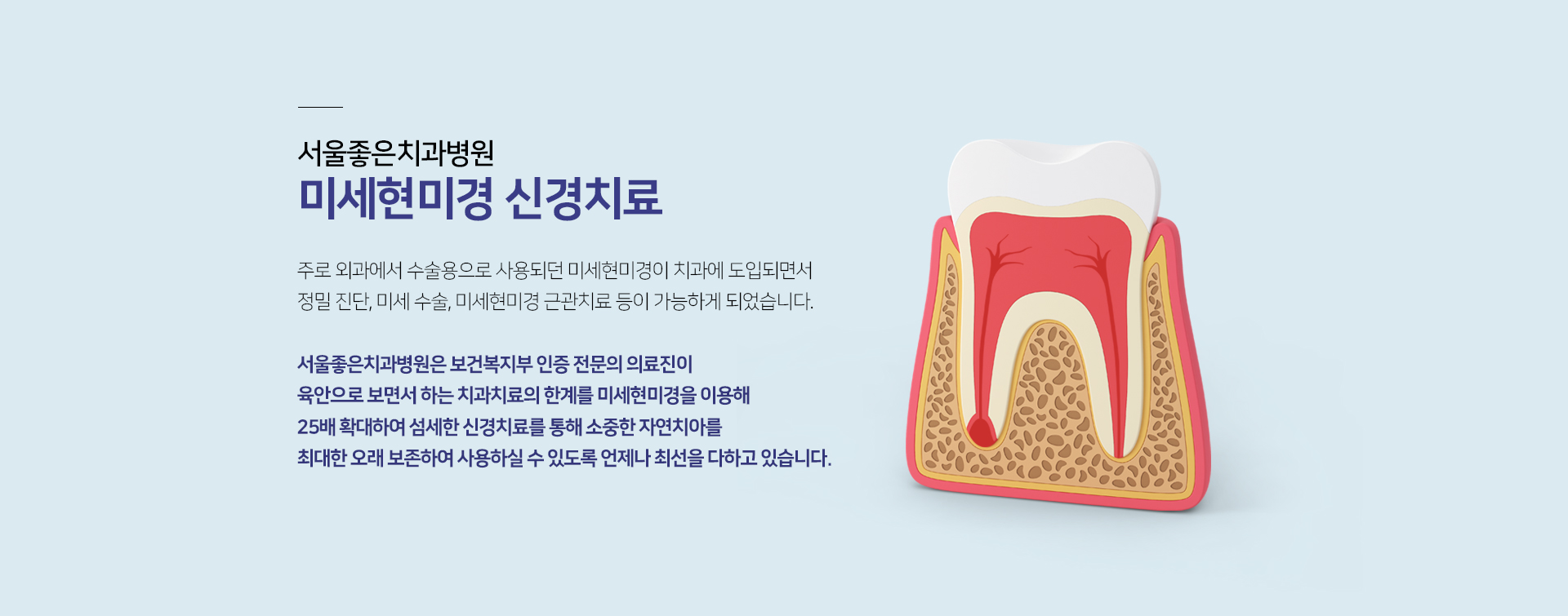 주로-외과에서-수술용으로-사용되던-미세현미경이-치과에-도입되면서-정밀-진단-미세-수술-미세현미경-근관치료-등이-가능하게-되었습니다-서울좋은치과병원은-보건복지부가-인증한-치과보존과-의료진이-육안으로-보면서-하는-치과치료의-한계를-미세현미경을-이용해-25배-확대하여-섬세한-신경치료를-통해-소중한-자연치아를-최대한-오래-보존하여-사용하실-수-있도록-언제나-최선을-다하고-있습니다