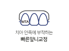 빠른앞니교정